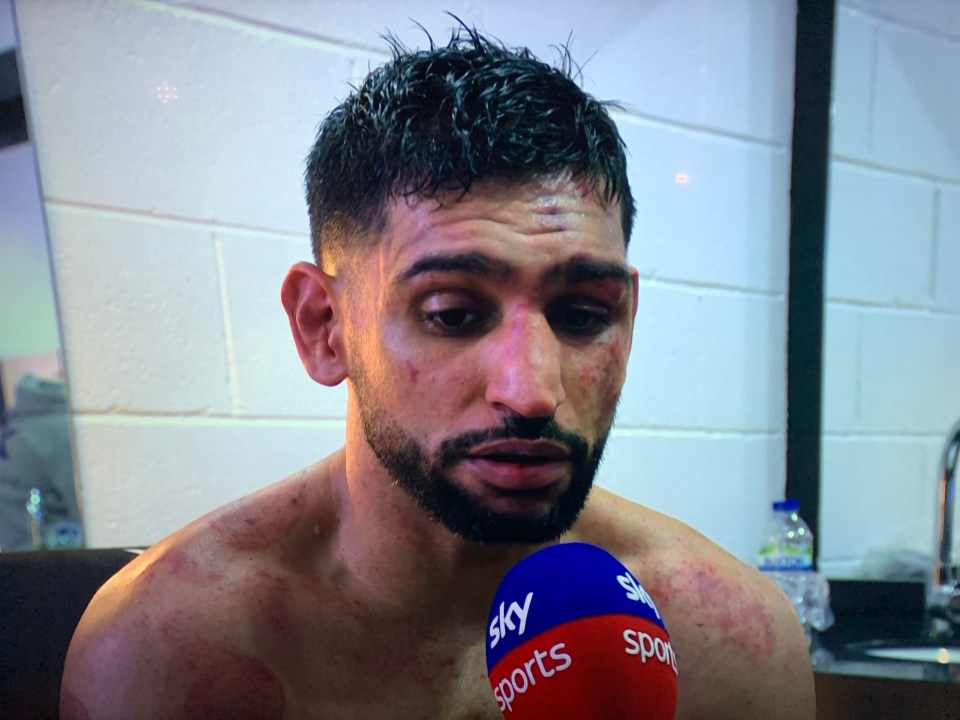 Amir Khan looks battered as he speaks after the fight