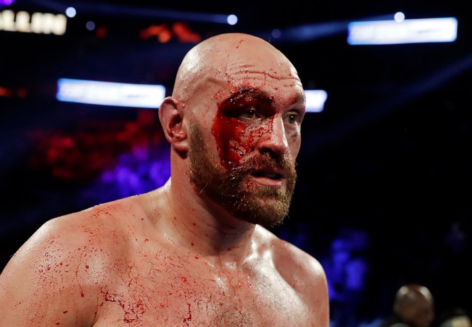 Tyson Fury was left with 47 stitches after fighting Otto Wallin