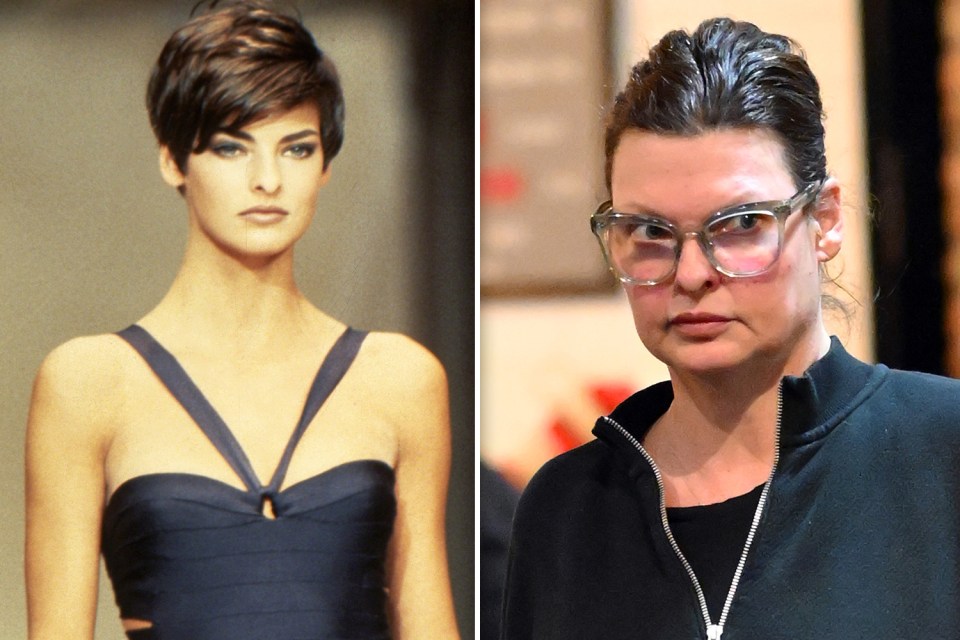 Former supermodel Linda Evangelista claimed she had become a recluse after a cosmetic procedure went wrong