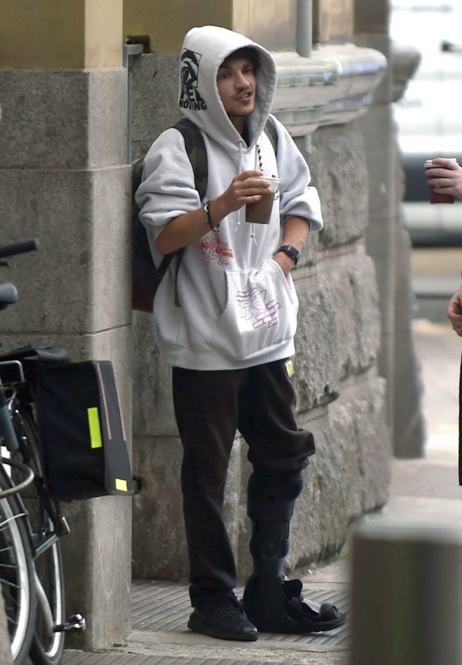 Corrie star Alex Bain showed off his moon boot after injuring his ankle