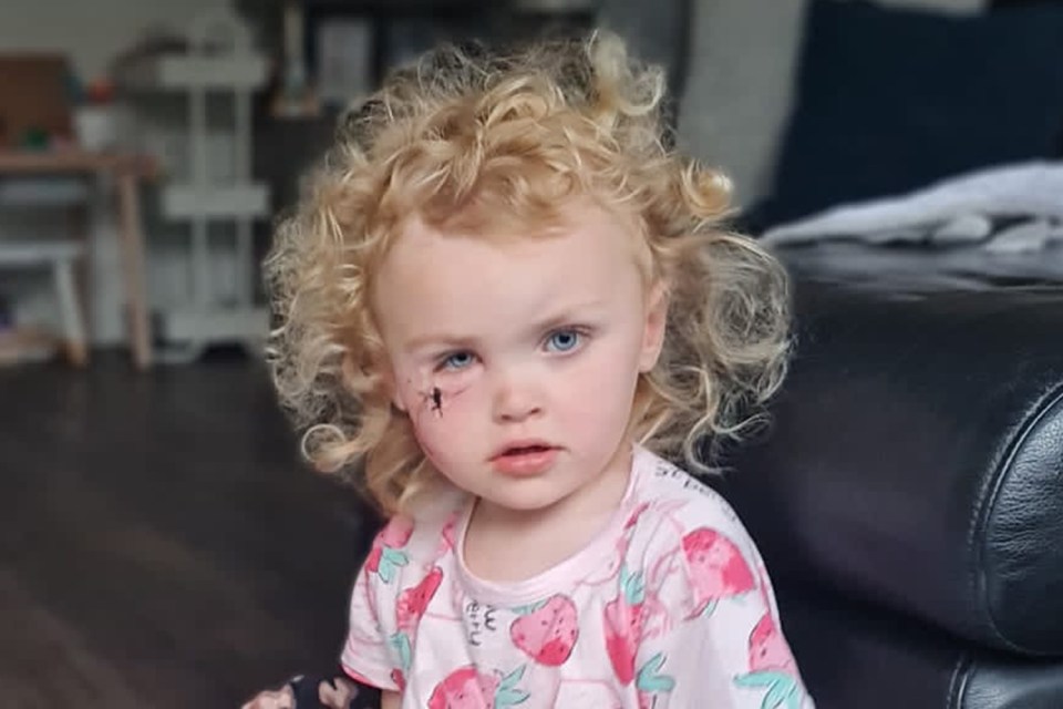 Stella was left with a deep gash on her face after she was mauled by a lurcher