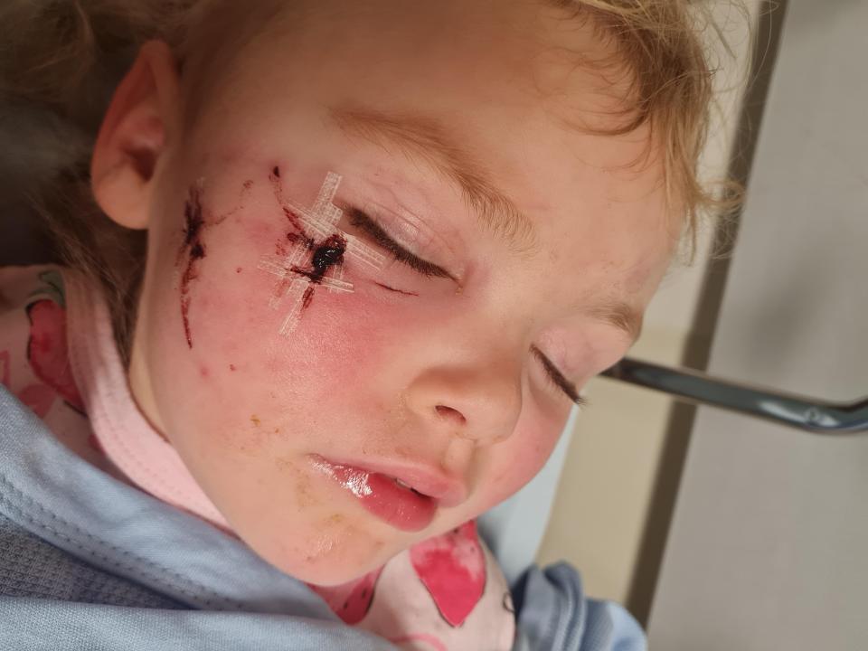A three-year-old girl could have lost an eye after she was attacked by a dog while playing in a garden