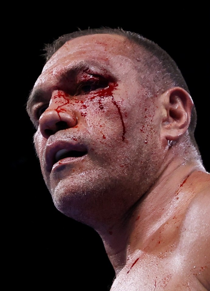 Pulev ended up suffering two horrific cuts