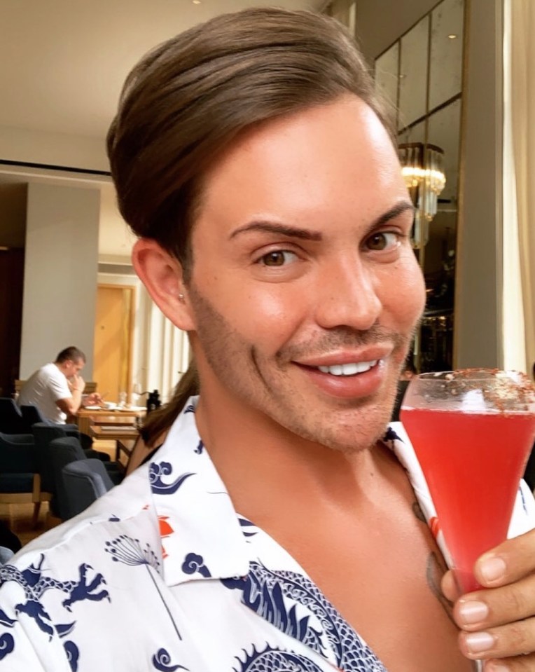 Bobby - pictured in 2018 - had a fair few cosmetic enhancements over the years