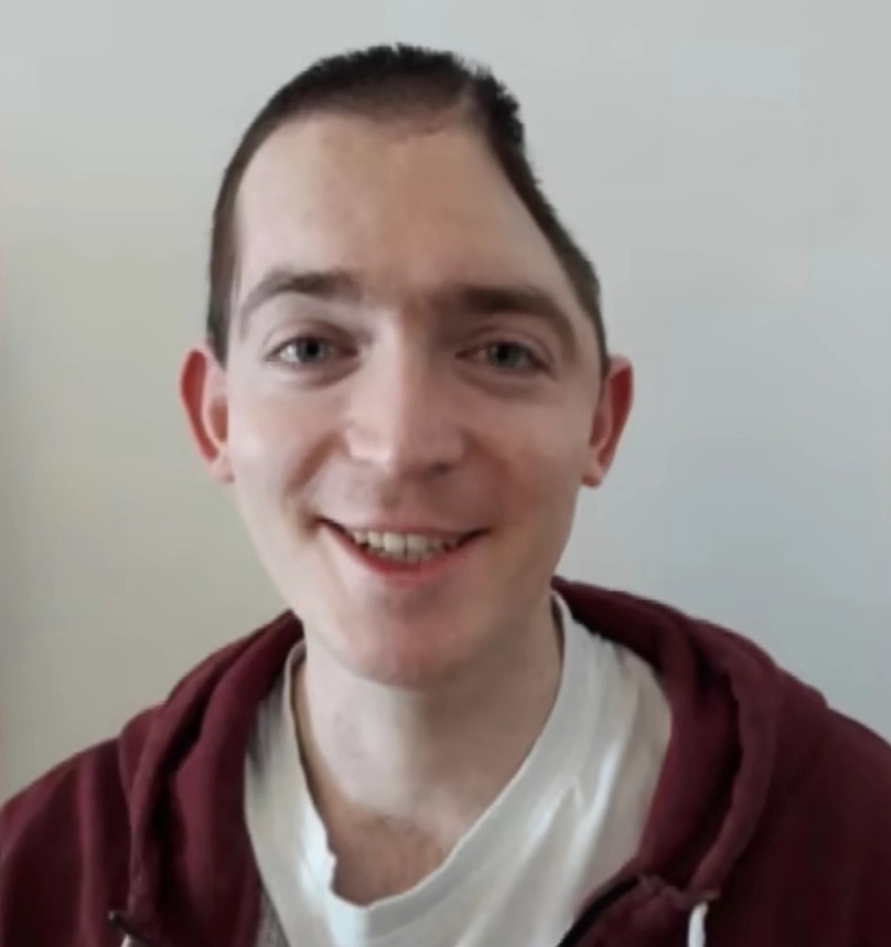 The auditor, dubbed a 'walking miracle', part of his skull removed by doctors