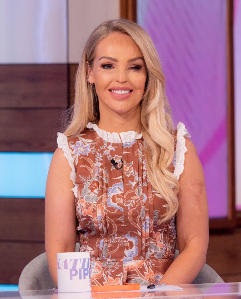 Loose Women star Katie Piper has revealed the shock reaction she faced after her acid attack