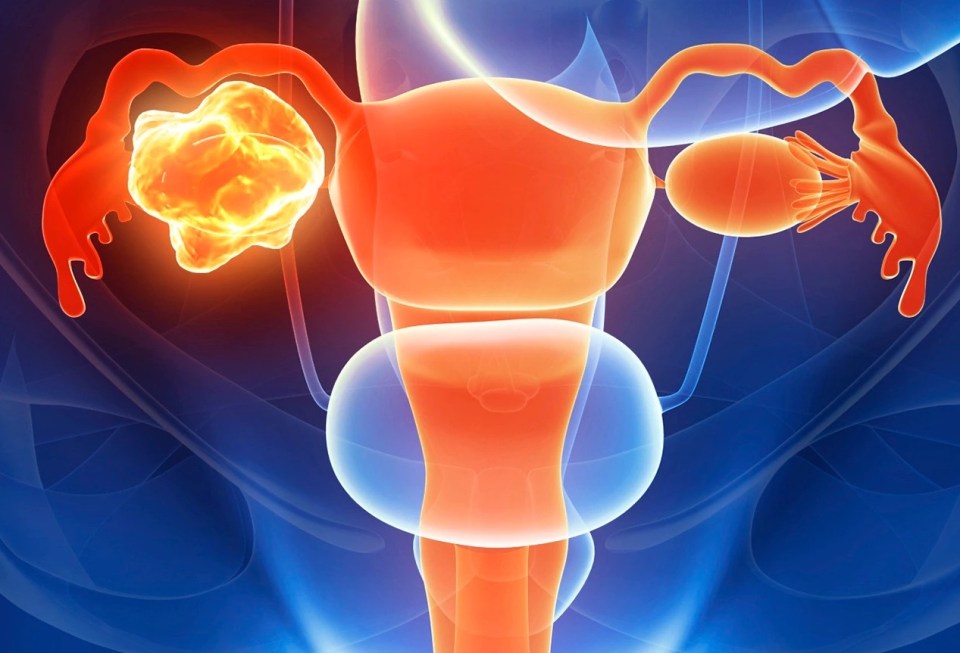 Blood spotting between your periods and abnormal odorous vaginal discharge are signs