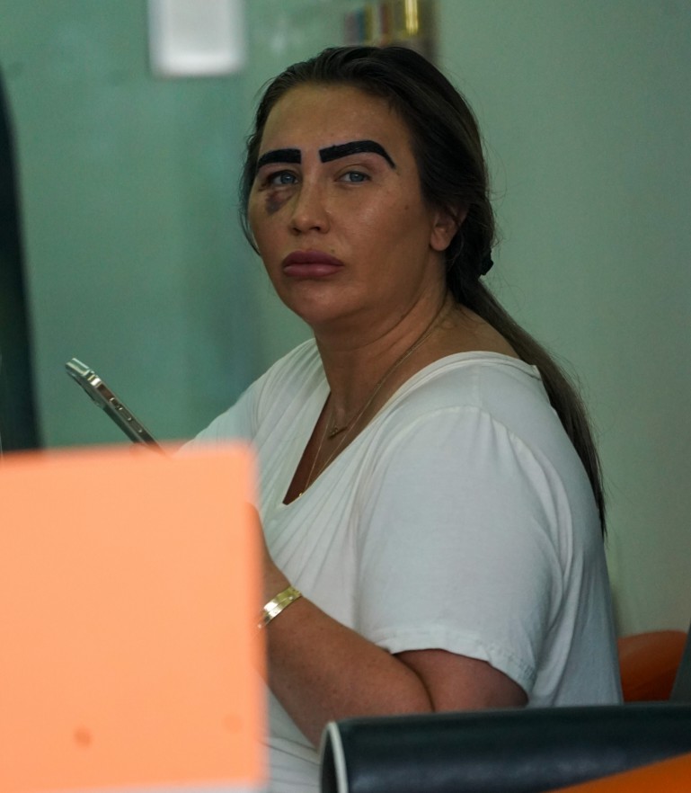 Lauren was spotted with a black eye at a beauty salon in Essex