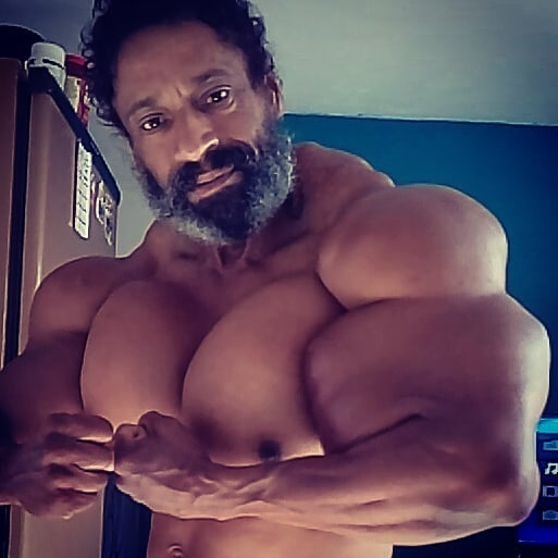 Segato ignored warnings from doctors over the dangers of his synthol injections