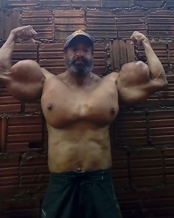 His crazy proportions were achieved by injecting himself with synthetic oil which included alcohol and painkillers