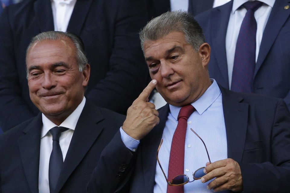 Barcelona President Joan Laporta was snapped with a black eye at the Nou Camp