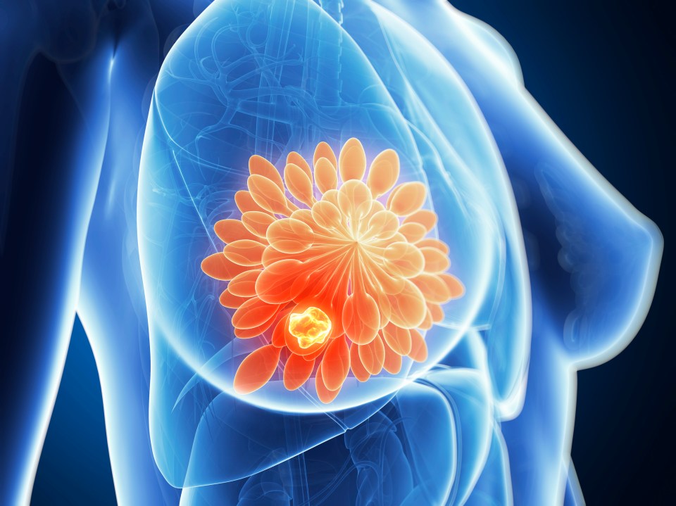 Look for changes in size, feel or look, including in the nipple area