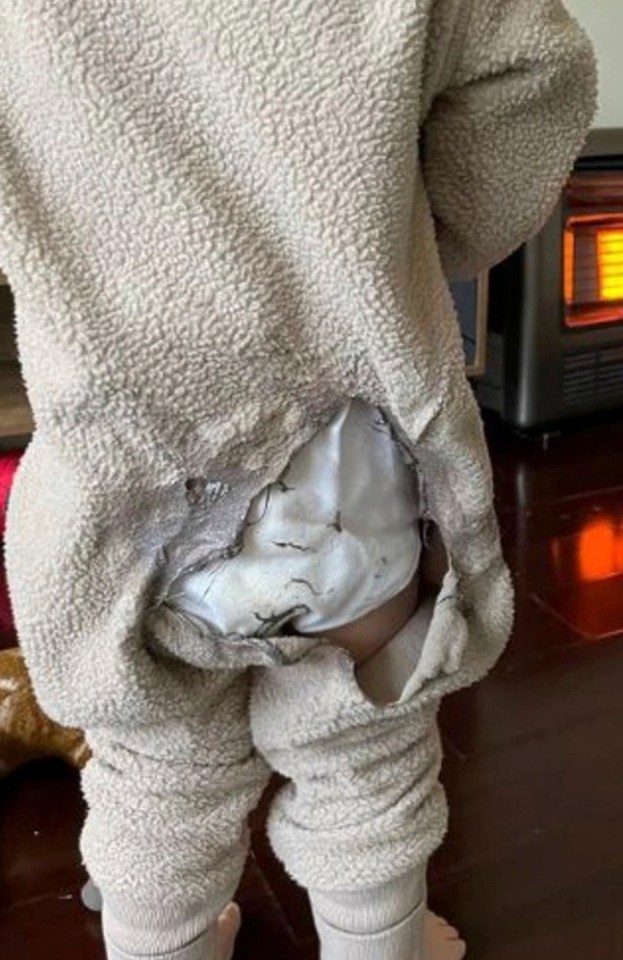 A two-year-old was nearly severely burned after standing near a gas heater