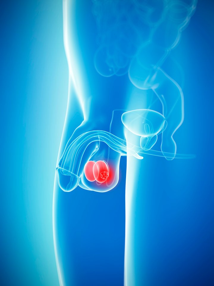 Look for thickening or lumps, swelling, redness or pain