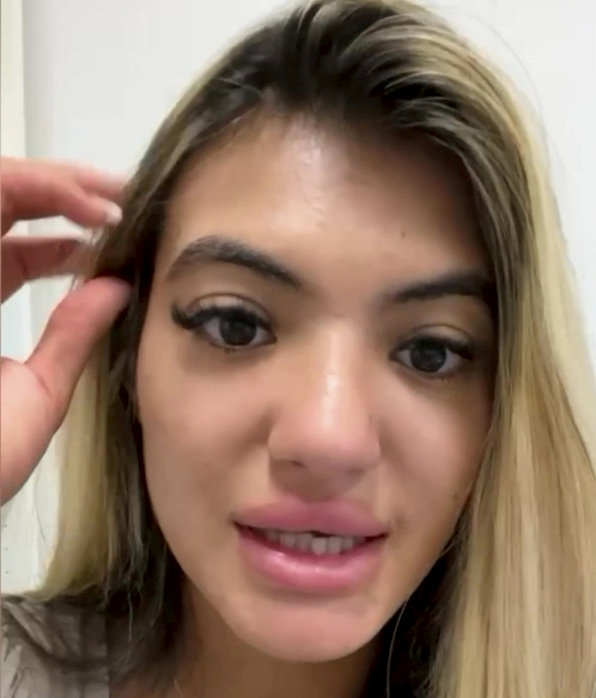 Luckily Sirin's skin has now recovered