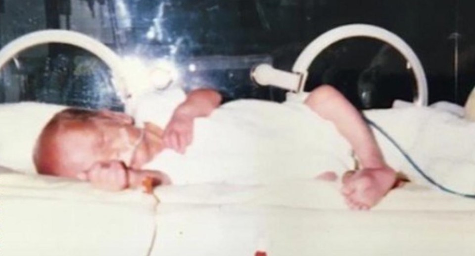 Murphy weighed just over 1kg - the same as a bag of sugar - when he was born 11 weeks premature