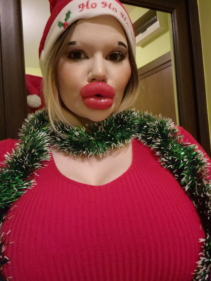 Andrea believes she has the world's biggest lips