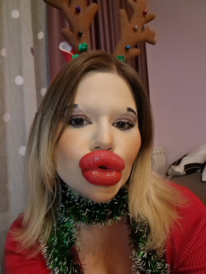 She plans to have even more work done
