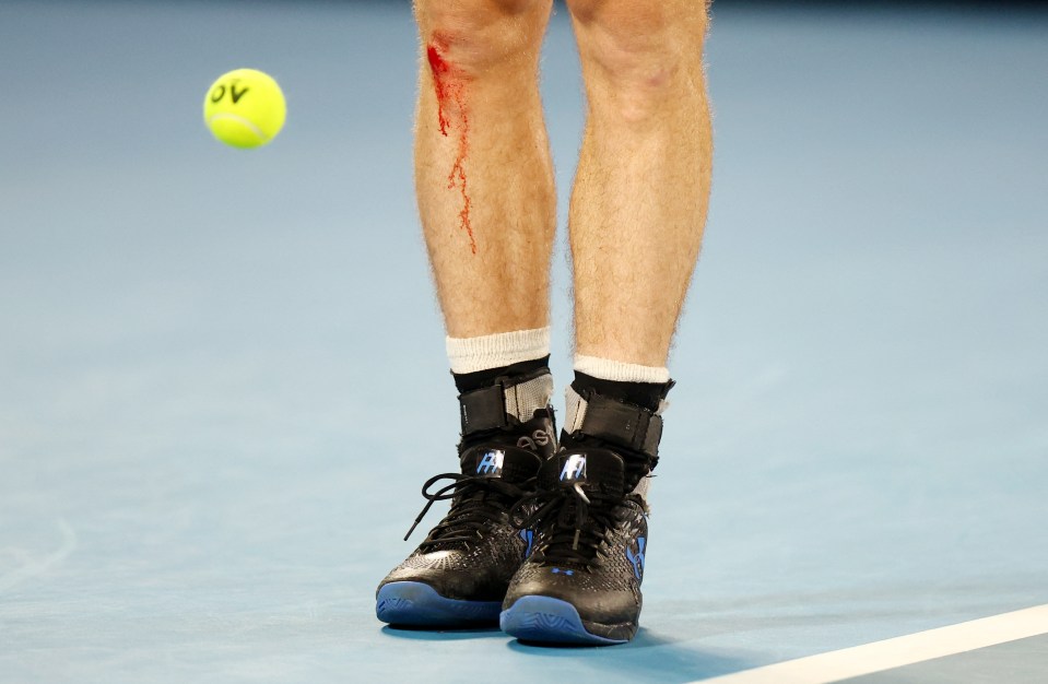 Murray cut his knee on the way to victory