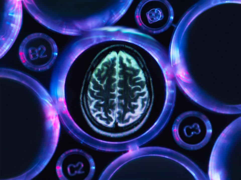 Bowel movements that are too infrequent are associated with declines in cognition