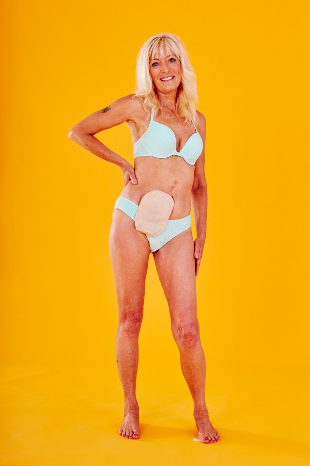 Christina Taylor's life was changed after she did a photoshoot in her colostomy bag