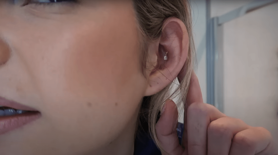 The former bombshell admitted that she wants surgery to get her ears pinned back