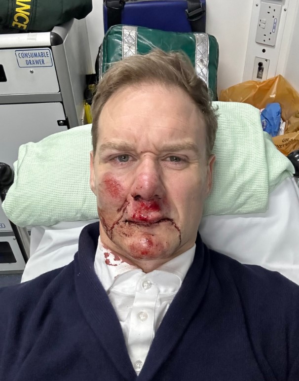 Dan has been sharing pictures of himself since the accident