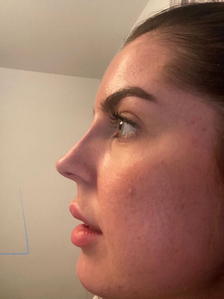 'I definitely feel more confident now and, when I take pictures, I am less likely to use a filter', says Loren