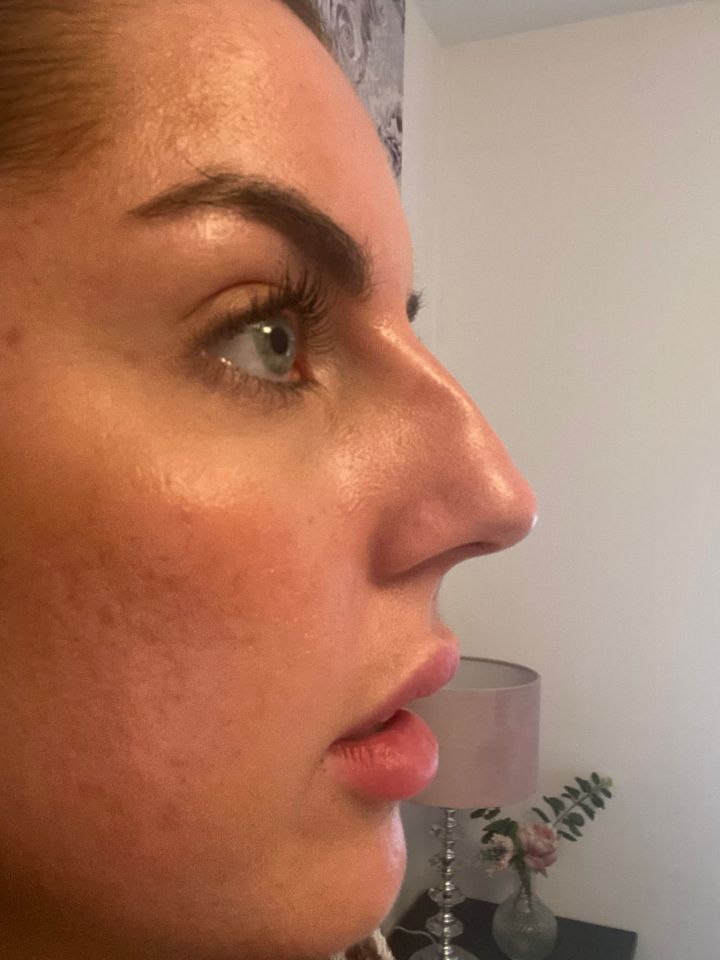 Loren's nose used to be an hourglass shape, so it went thinner in the middle
