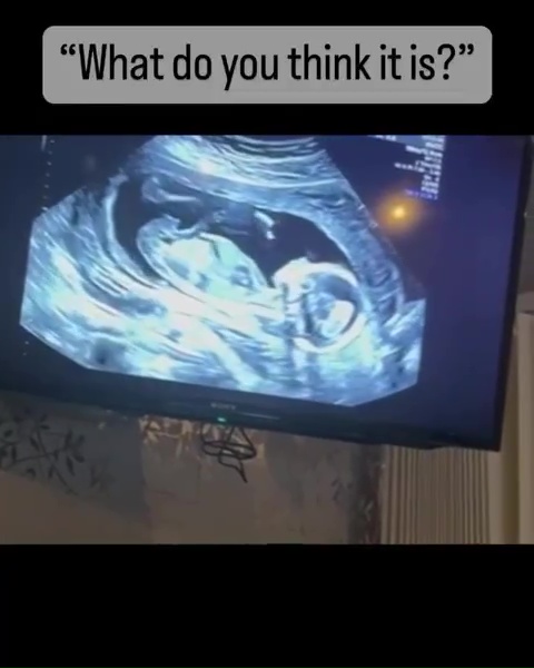 Kane asked fans what gender the baby will be