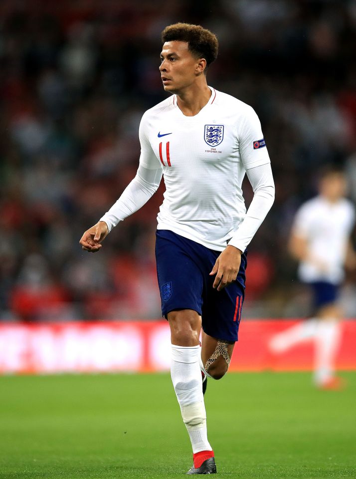 File photo dated 08-09-2018 of England's Dele Alli. PRESS ASSOCIATION Photo. Issue date: Monday September 10, 2018. Tottenham midfielder Dele Alli has been ruled out of England¿s friendly against Switzerland on Tuesday night due to a minor muscle strain, the Football Association has announced. See PA story SOCCER England. Photo credit should read Adam Davy/PA Wire