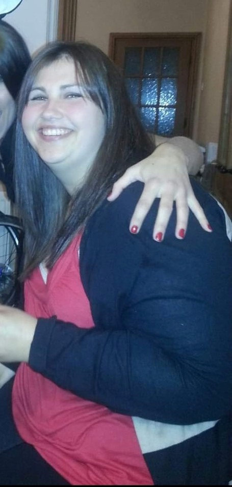 **Sent under embargo ¿ no use before 14.00pm BST April 2 2023** Melissa Jones before weight loss, at 19st. See SWNS story SWFTcrisps. A crisp addict who was chomping through a multipack per day has lost 7 stone after gastric sleeve surgery- and is now splashing ¿12k to remove piles of loose skin. Snack enthusiast, Melissa Jones, 38, saw her weight rocket after munching 24 packets of crisps a day, as well as fast food at least three to four times a week. Unable to stick to diets or lose weight naturally, Melissa, then a size 24 and weighing 19 stone, decided enough was enough after not being able to fit in a pedalo seat on holiday with her young sons. After returning home in October 2013, she started looking into getting surgical help to shift her weight.