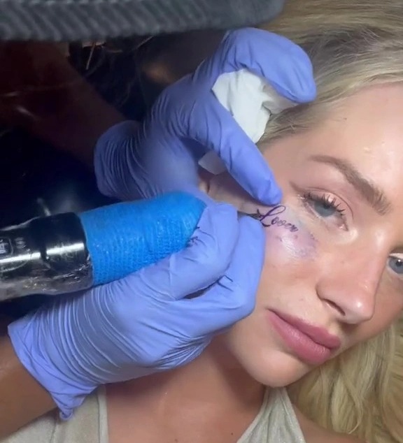 Lottie Moss is sensibly getting her face tattoo removed