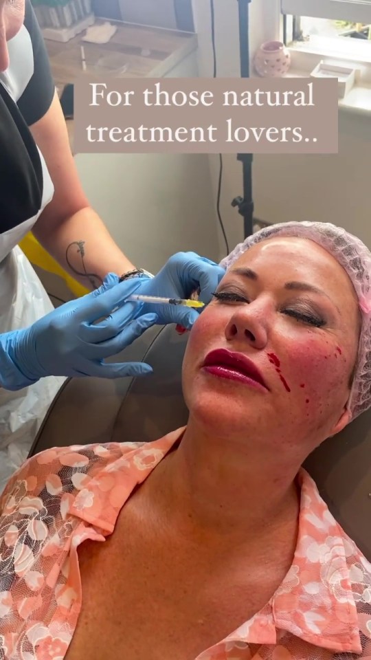She has spent a fortune on anti-aging treatments