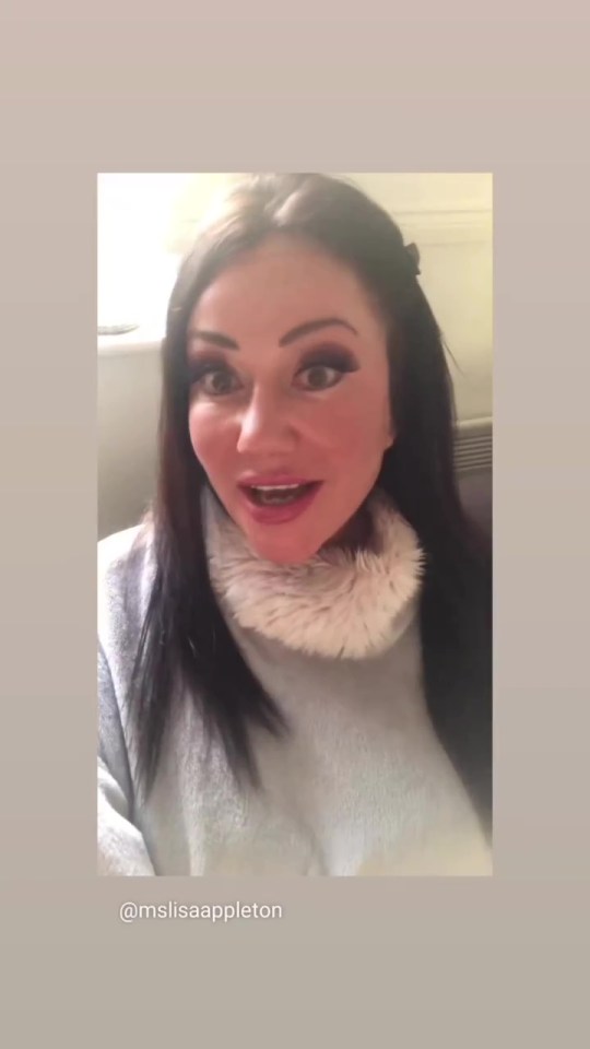 Lisa's appearance has changed a lot since her time on the hit show