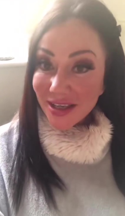 Lisa had added some fillers to her face to beat ageing
