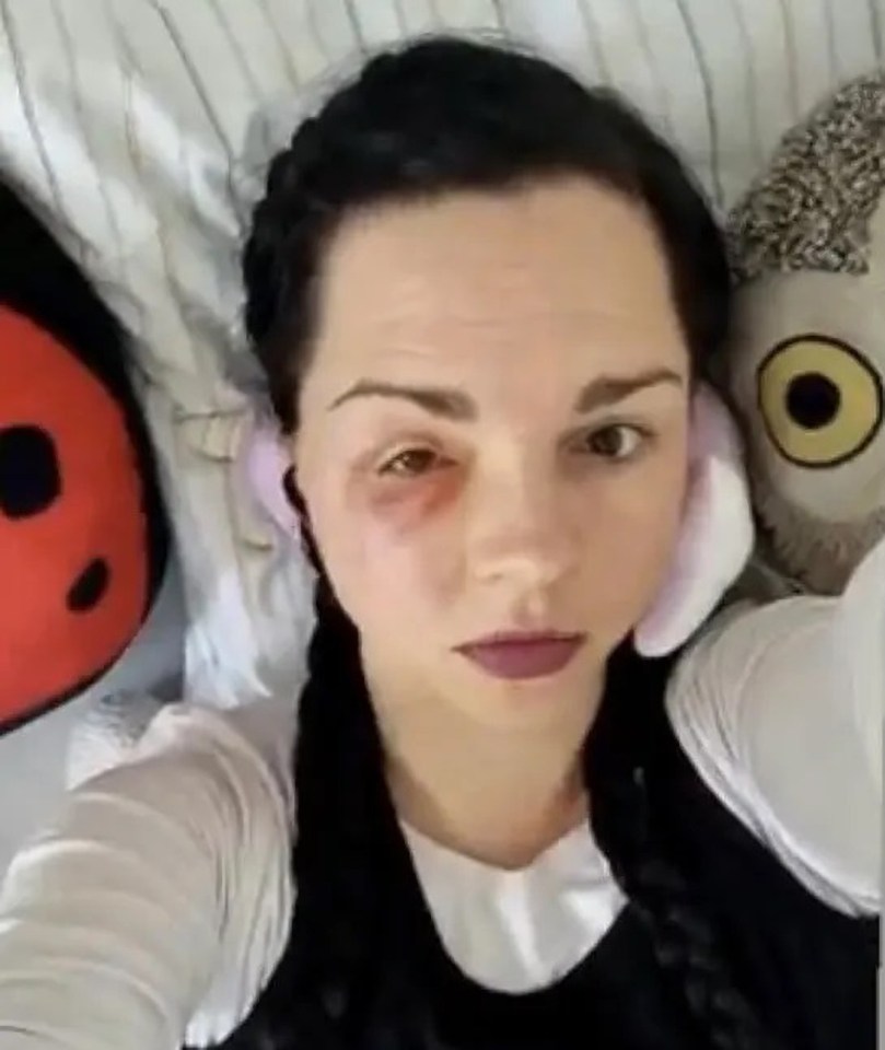 Jessica Leidolph has had three major surgeries after being attacked by a leopard during a shoot