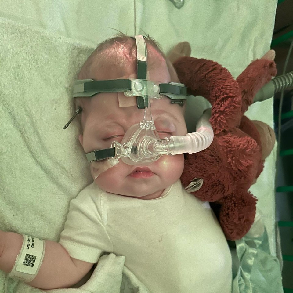 The little boy was born with a very rare genetic syndrome