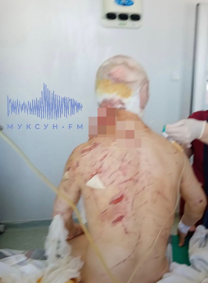 The bear clawed at his body and sank its razor sharp teeth into his head.