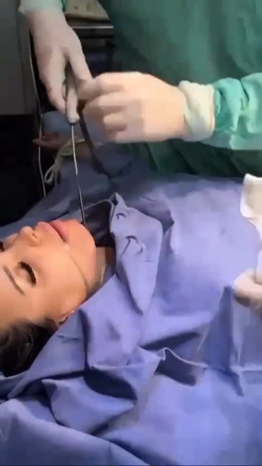 Charlotte Caniggia has shared a video of her latest plastic surgery