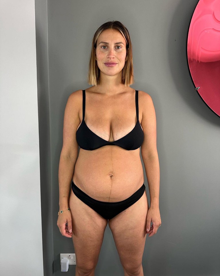Ferne McCann was praised by her fans for sharing a snap of her post-partum body