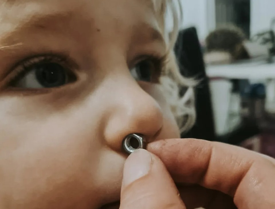 Children often get stuff stuck up their nose and there's a safe and effective way to get it out, according to medics