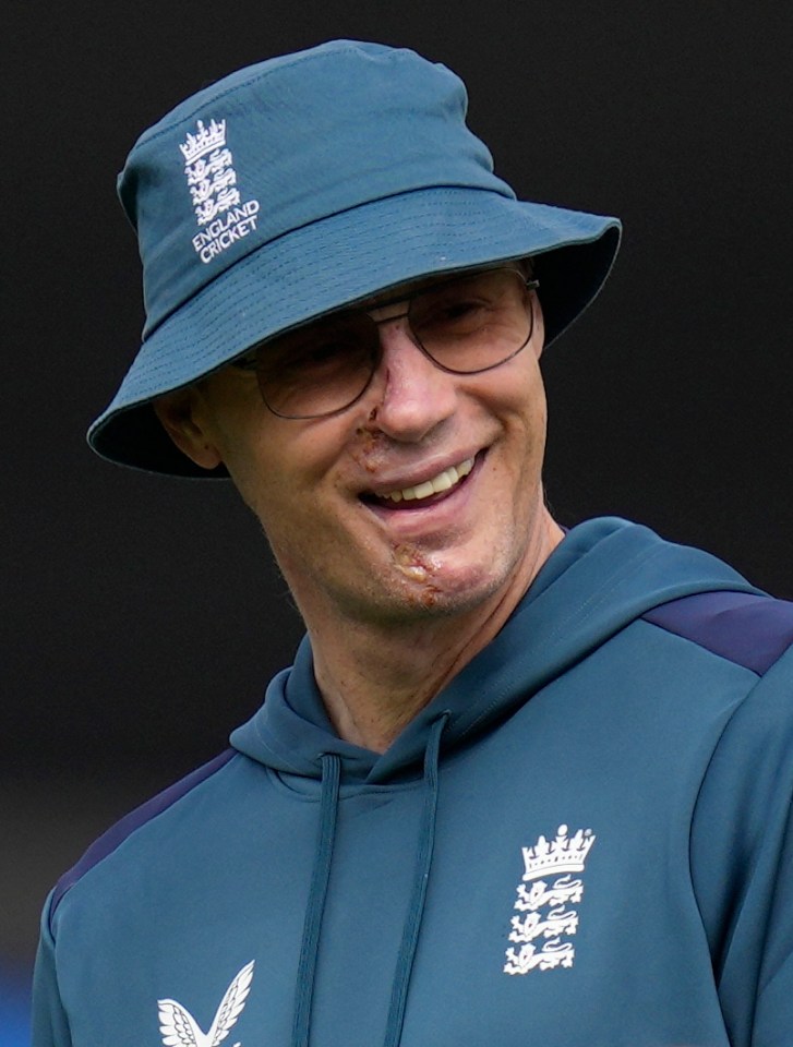 Freddie was spotted training the England cricket team back in September