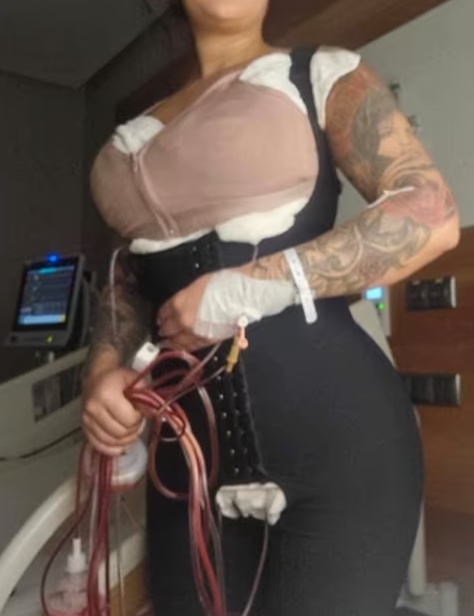 The 33-year-old mum had gotten a boob job, lipo, and a Brazilian butt lift