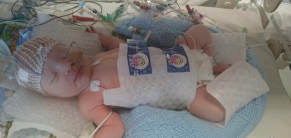 The youngster in hospital after being born without a heartbeat