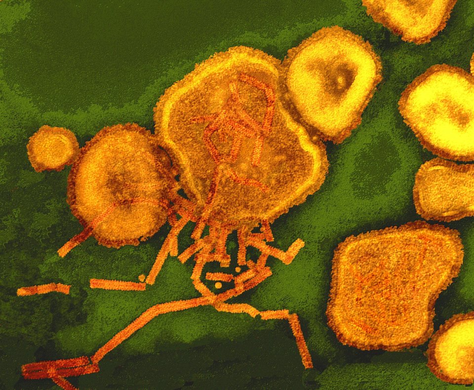 Coloured transmission electron micrograph of paramyxovirus particles.