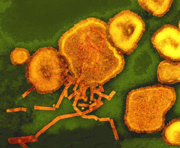 Coloured transmission electron micrograph of paramyxovirus particles.