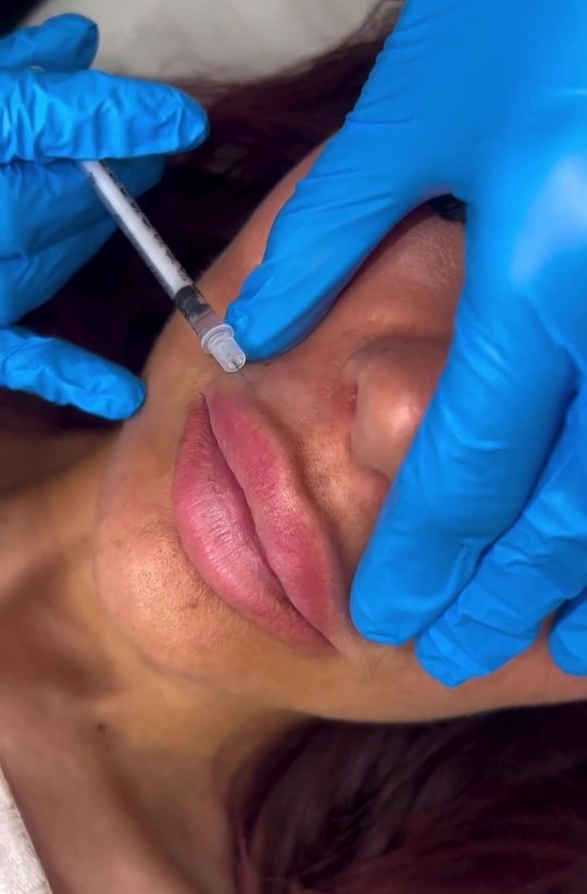 a woman is getting a botox injection in her lips