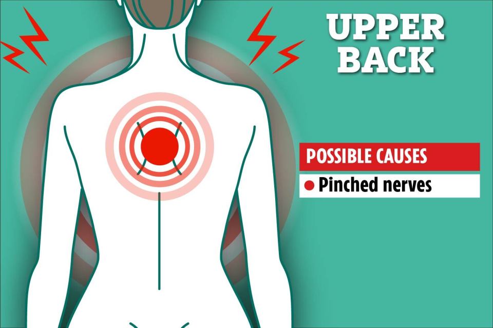 Upper back pain can be caused by pinched nerves