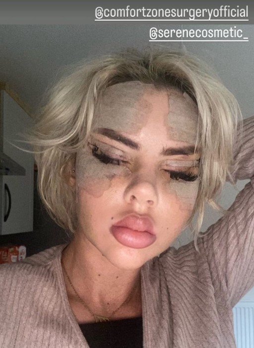 Hannah had fox eye surgery